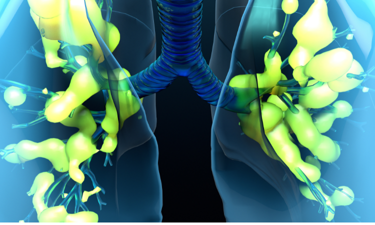 Read more about the article Acute Respiratory Distress Syndrome Market Size and Share Report 2024-2032