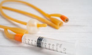 Read more about the article Balloon Catheter Market Share and Size Forecast Report 2024-2032