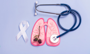 Read more about the article Lung Cancer Screening Market Size and Share Report 2023-2028