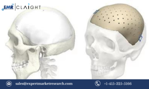 Read more about the article Cranial Implants Market Size, Share, Trends, Report (2024-2032)