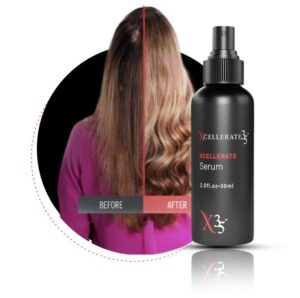 Read more about the article The Ultimate Hair Serum for damaged hair Growth and Vitality | hair loss serum– XCellerate 35