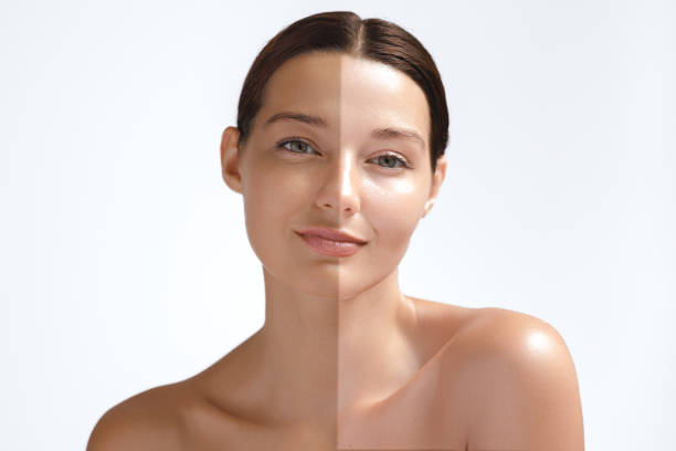 Read more about the article Mesotherapy for Face: Effective Meso Treatments for a Youthful Glow