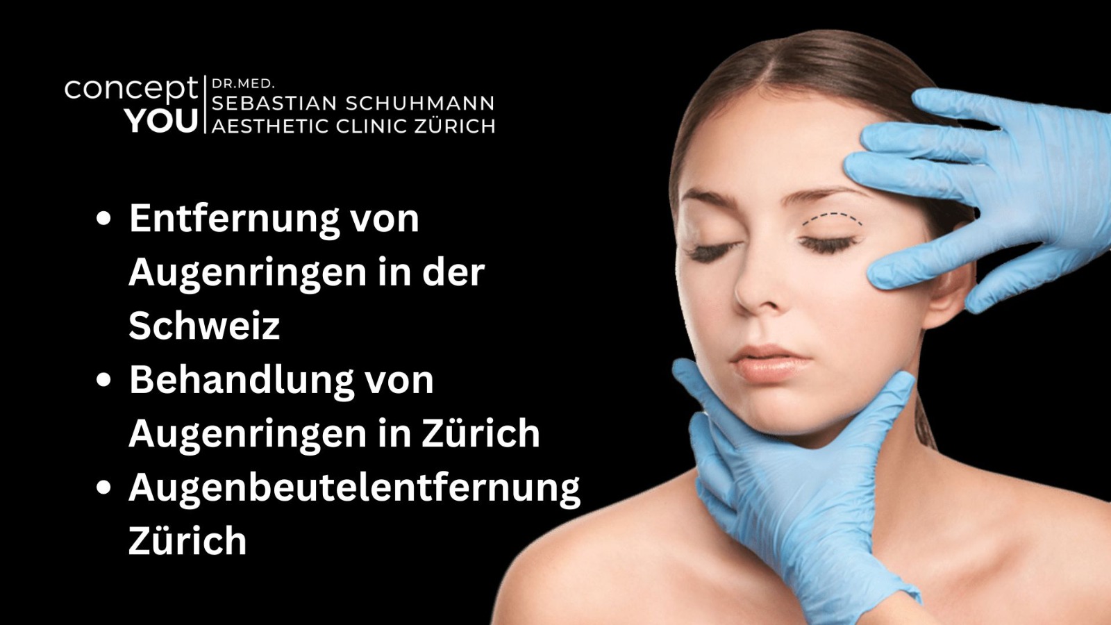 Read more about the article Effektive Hautbehandlung auf concept-you.ch