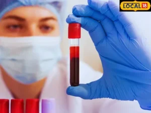 Read more about the article Blood Analysis Melbourne: For Accurate Health Insights