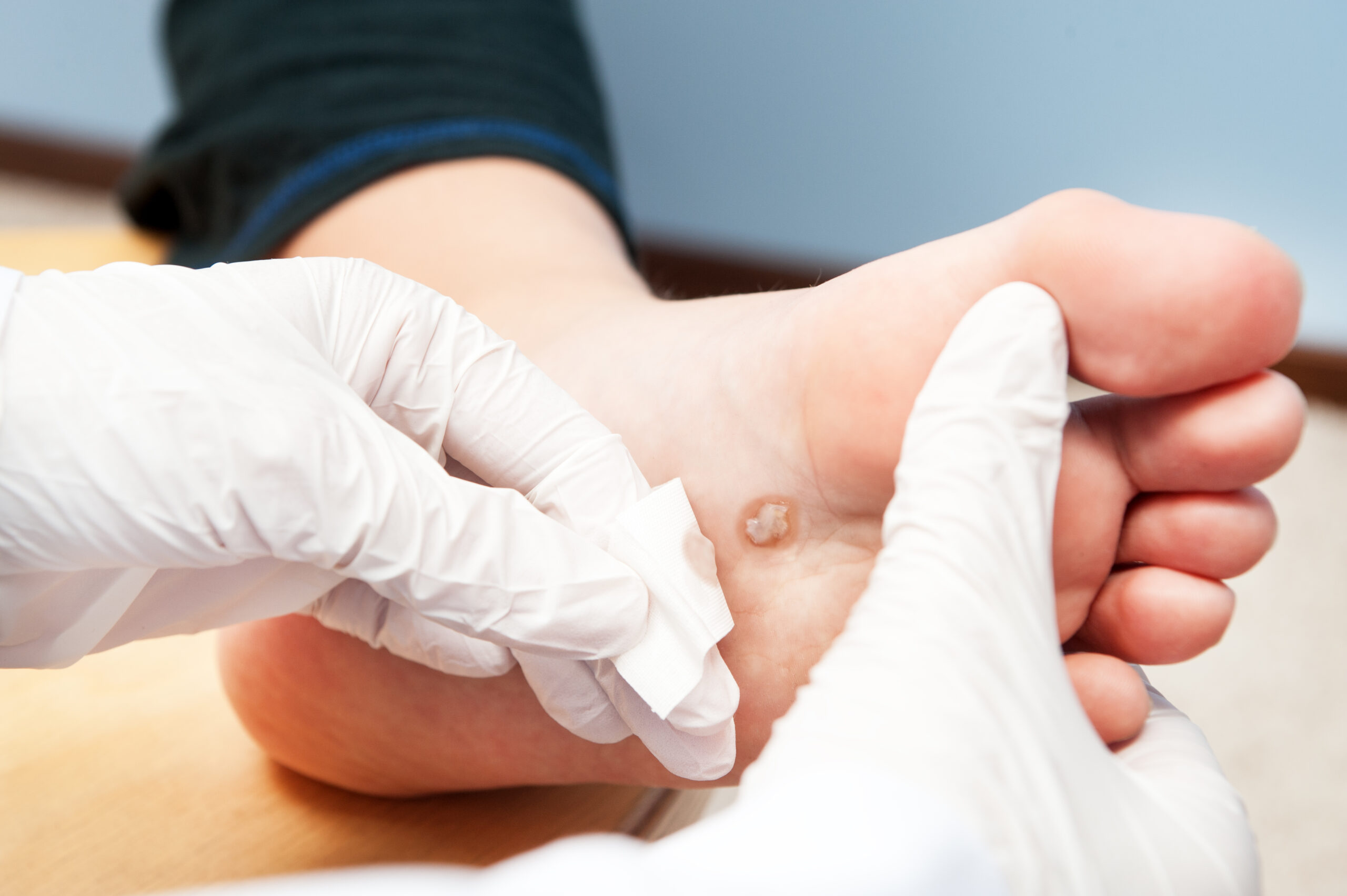 Read more about the article Advanced Foot Care at Our Podiatry Clinic in Edinburgh