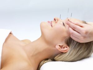 Read more about the article How does Chinese acupuncture support healing naturally?