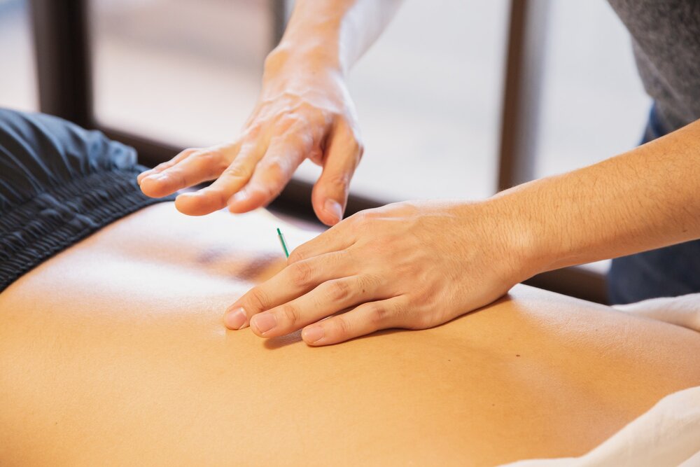 You are currently viewing What are the benefits of visiting a licensed acupuncturist?