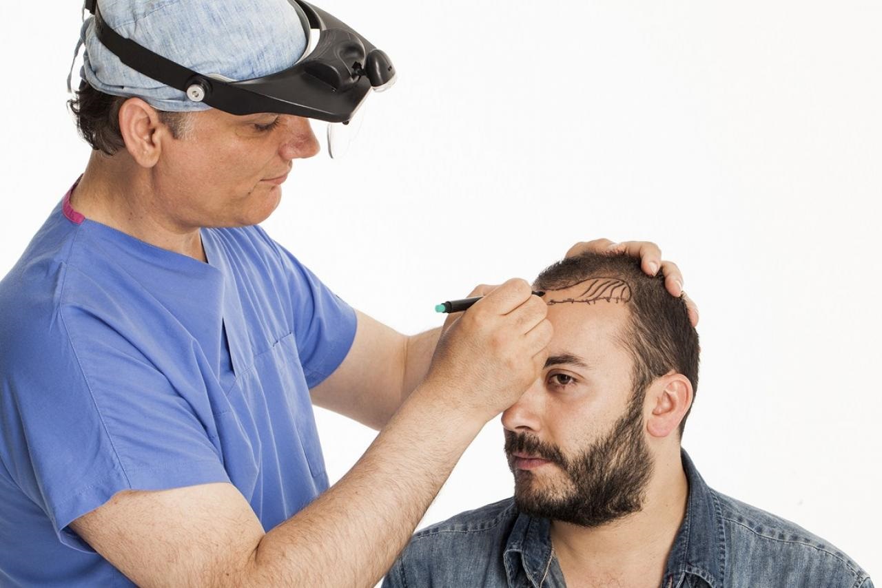 Read more about the article Hair Transplant Cost: A Beginner’s Guide for 2024