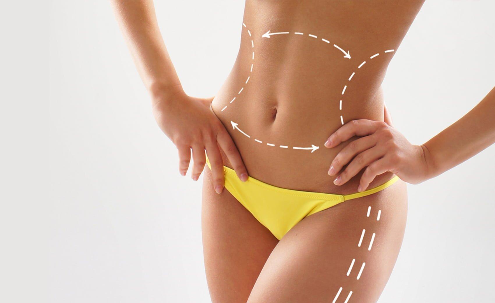 Read more about the article Liposuction Surgery in Dubai: Costs and What to Know