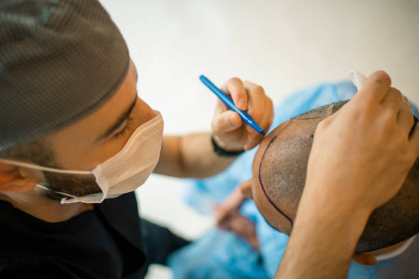 You are currently viewing Dubai Hair Transplant Costs Explained by Experts