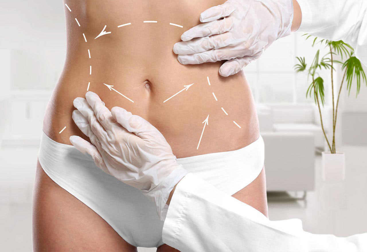 Read more about the article Achieve Your Dream Body with Liposuction Surgery in Dubai