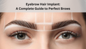 Read more about the article Eyebrow Hair Implant: A Complete Guide to Perfect Brows