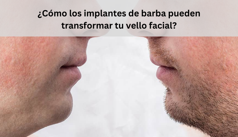 Read more about the article ¿Cómo los implantes de barba pueden transformar tu vello facial?