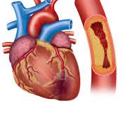 Read more about the article Myocardial Infarction Market Size And Forecast Report 2024-2032