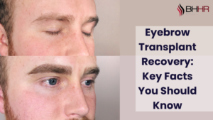 Read more about the article Eyebrow Transplant Recovery: What You Need to Know