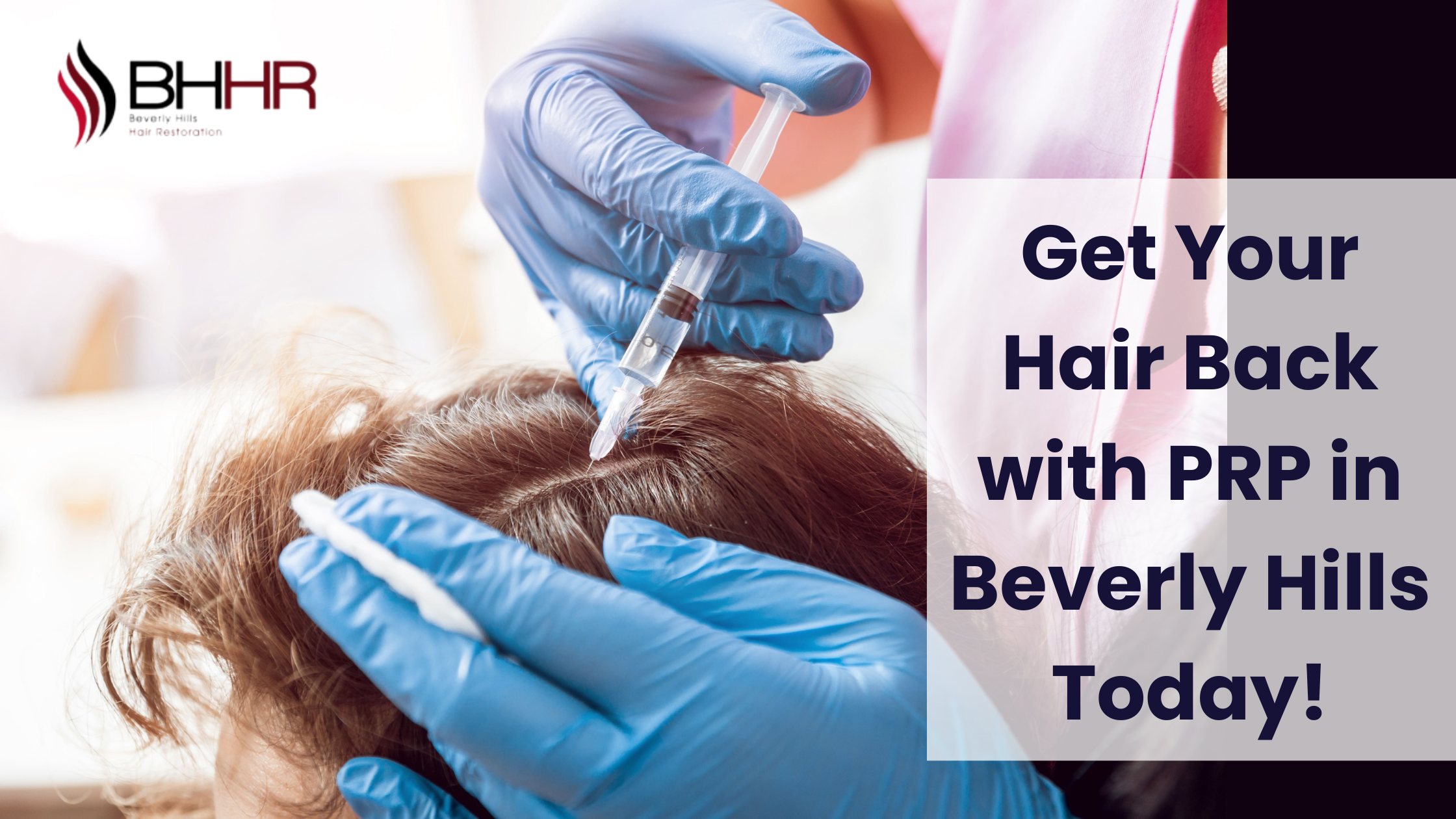 Read more about the article Get Your Hair Back with PRP in Beverly Hills Today!