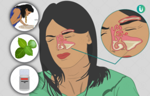 Read more about the article Sinusitis Drug Pipeline Analysis Report 2024