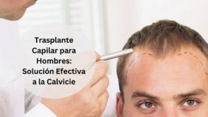 Read more about the article Trasplante Capilar para Hombres: Solución Efectiva a la Calvicie