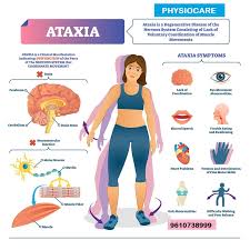 Read more about the article Physiotherapy for Ataxia: Improving Mobility and Coordination