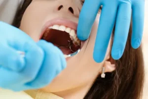 Read more about the article Management Tips for Tooth Extractions Alexandria